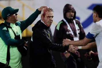 Главный тренер сборной Мексики Агирре получил травму из-за инцидента на трибунах