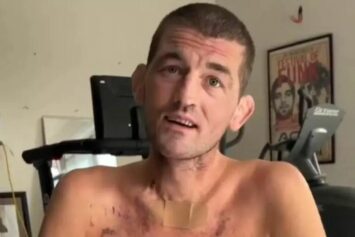 Бен Аскрен озвучил детали тяжелой реабилитации