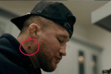 Джастин Гейджи опроверг слухи о стафилококке накануне UFC 324